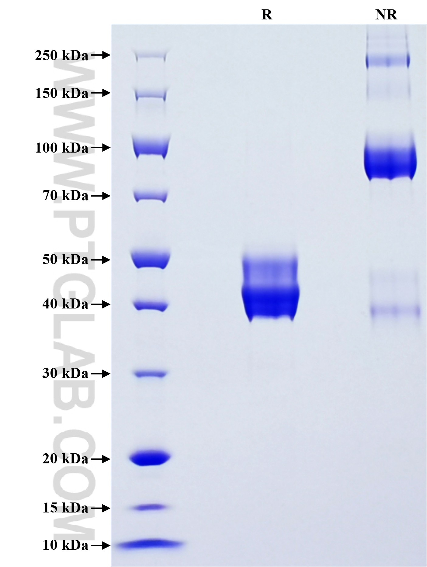 Purity of Recombinant Human UBL3 was determined by SDS-PAGE. The protein was resolved in an SDS-PAGE in reducing (R) and non-reducing (NR) conditions and stained using Coomassie blue. Purity of Recombinant Human UBL3 was determined by SDS-PAGE. The protein was resolved in an SDS-PAGE in reducing (R) and non-reducing (NR) conditions and stained using Coomassie blue.