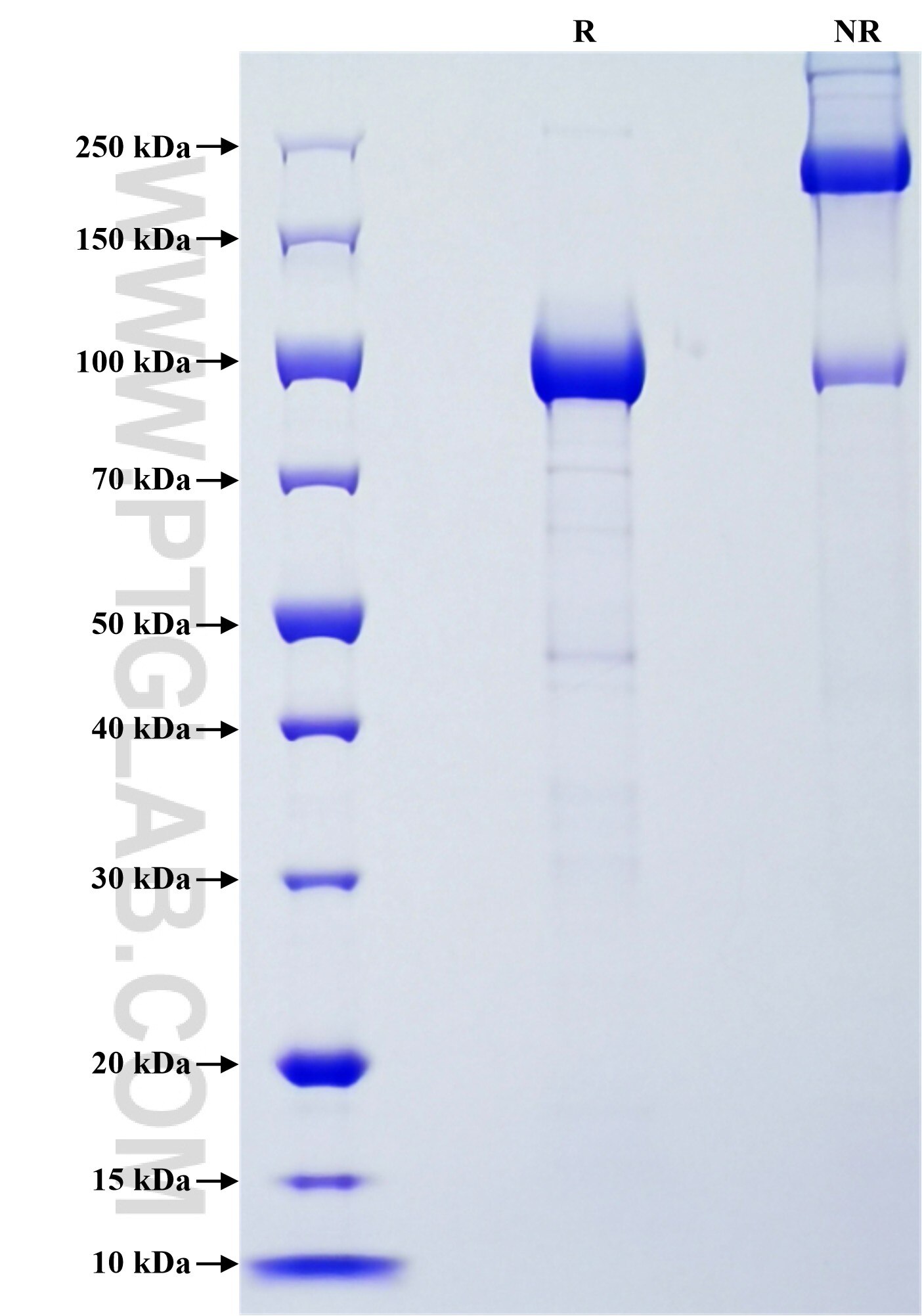 Purity of Recombinant Human Cadherin-13 was determined by SDS-PAGE. The protein was resolved in an SDS-PAGE in reducing (R) and non-reducing (NR) conditions and stained using Coomassie blue.