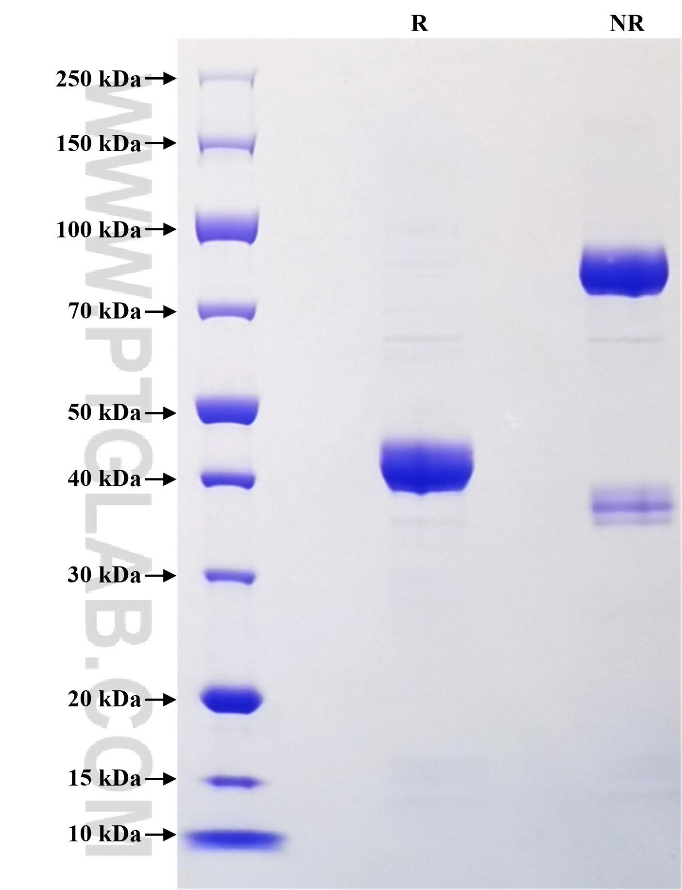 Purity of Recombinant Human NRAC was determined by SDS-PAGE. The protein was resolved in an SDS-PAGE in reducing (R) and non-reducing (NR) conditions and stained using Coomassie blue.