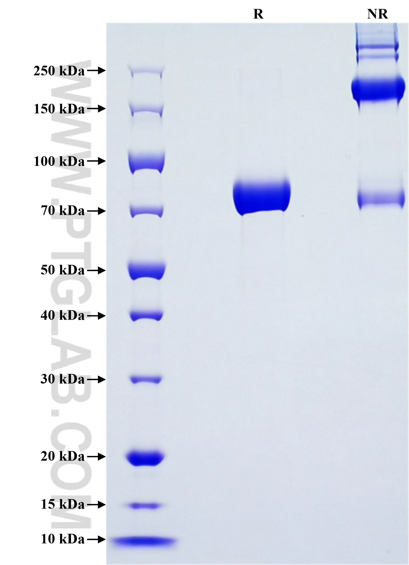 Purity of Recombinant Human MINP1 was determined by SDS-PAGE. The protein was resolved in an SDS-PAGE in reducing (R) and non-reducing (NR) conditions and stained using Coomassie blue.