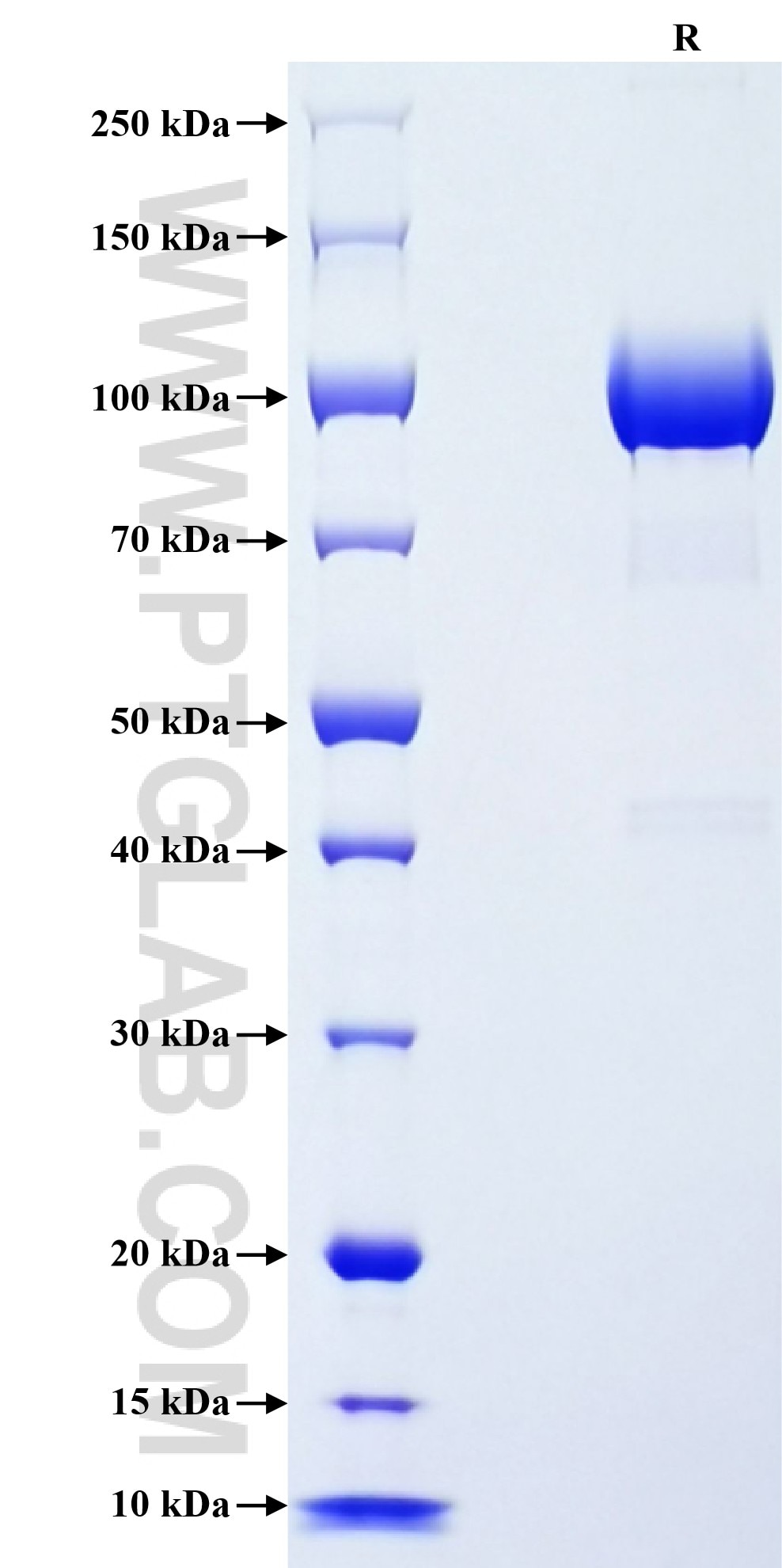 Purity of Recombinant Human XPNPEP2 was determined by SDS-PAGE. The protein was resolved in an SDS-PAGE in reducing (R) conditions and stained using Coomassie blue. Purity of Recombinant Human XPNPEP2 was determined by SDS-PAGE. The protein was resolved in an SDS-PAGE in reducing (R) conditions and stained using Coomassie blue.