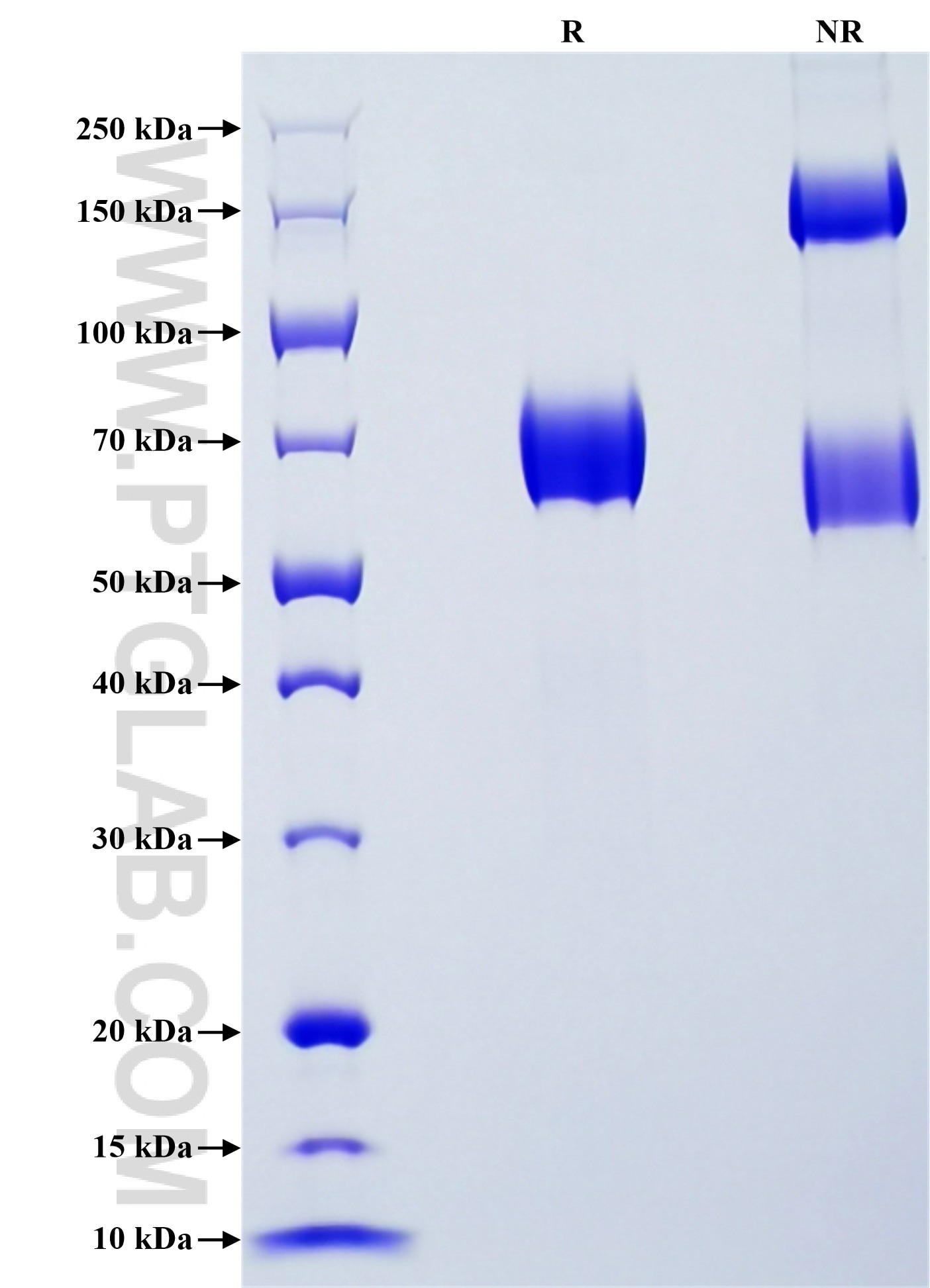 Purity of Recombinant Human MICB was determined by SDS-PAGE. The protein was resolved in an SDS-PAGE in reducing (R) and non-reducing (NR) conditions and stained using Coomassie blue. Purity of Recombinant Human MICB was determined by SDS-PAGE. The protein was resolved in an SDS-PAGE in reducing (R) and non-reducing (NR) conditions and stained using Coomassie blue.