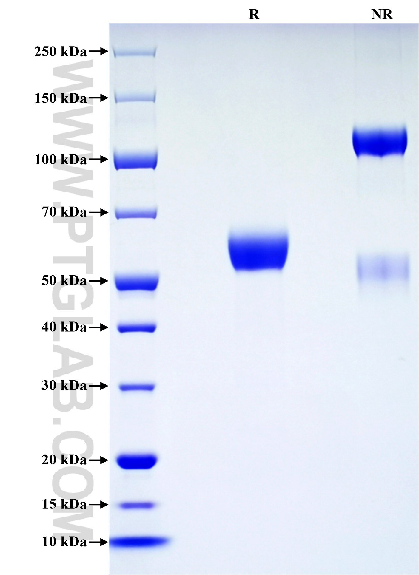 Purity of Recombinant Mouse LTBR was determined by SDS-PAGE. The protein was resolved in an SDS-PAGE in reducing (R) and non-reducing (NR) conditions and stained using Coomassie blue. Purity of Recombinant Mouse LTBR was determined by SDS-PAGE. The protein was resolved in an SDS-PAGE in reducing (R) and non-reducing (NR) conditions and stained using Coomassie blue.