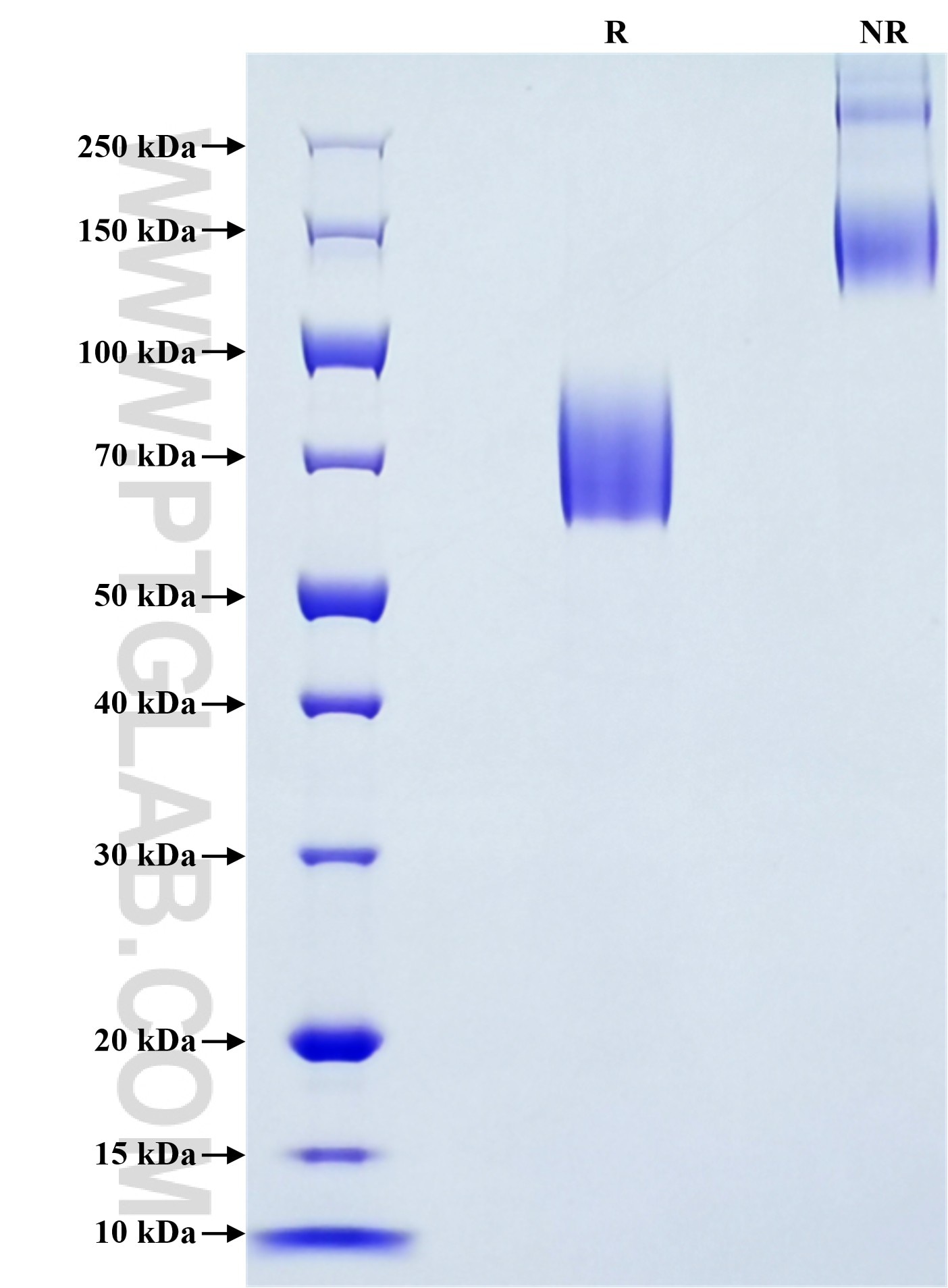 Purity of Recombinant Human EMB was determined by SDS-PAGE. The protein was resolved in an SDS-PAGE in reducing (R) and non-reducing (NR) conditions and stained using Coomassie blue.