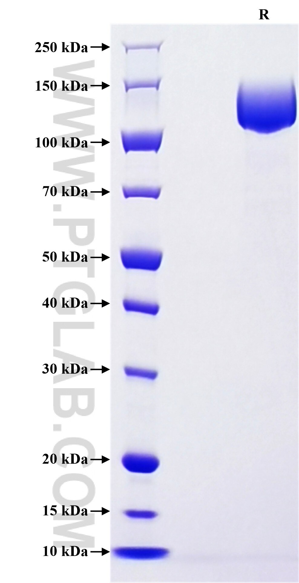Purity of Recombinant Human MUC16 was determined by SDS-PAGE. The protein was resolved in an SDS-PAGE in reducing (R) conditions and stained using Coomassie blue.