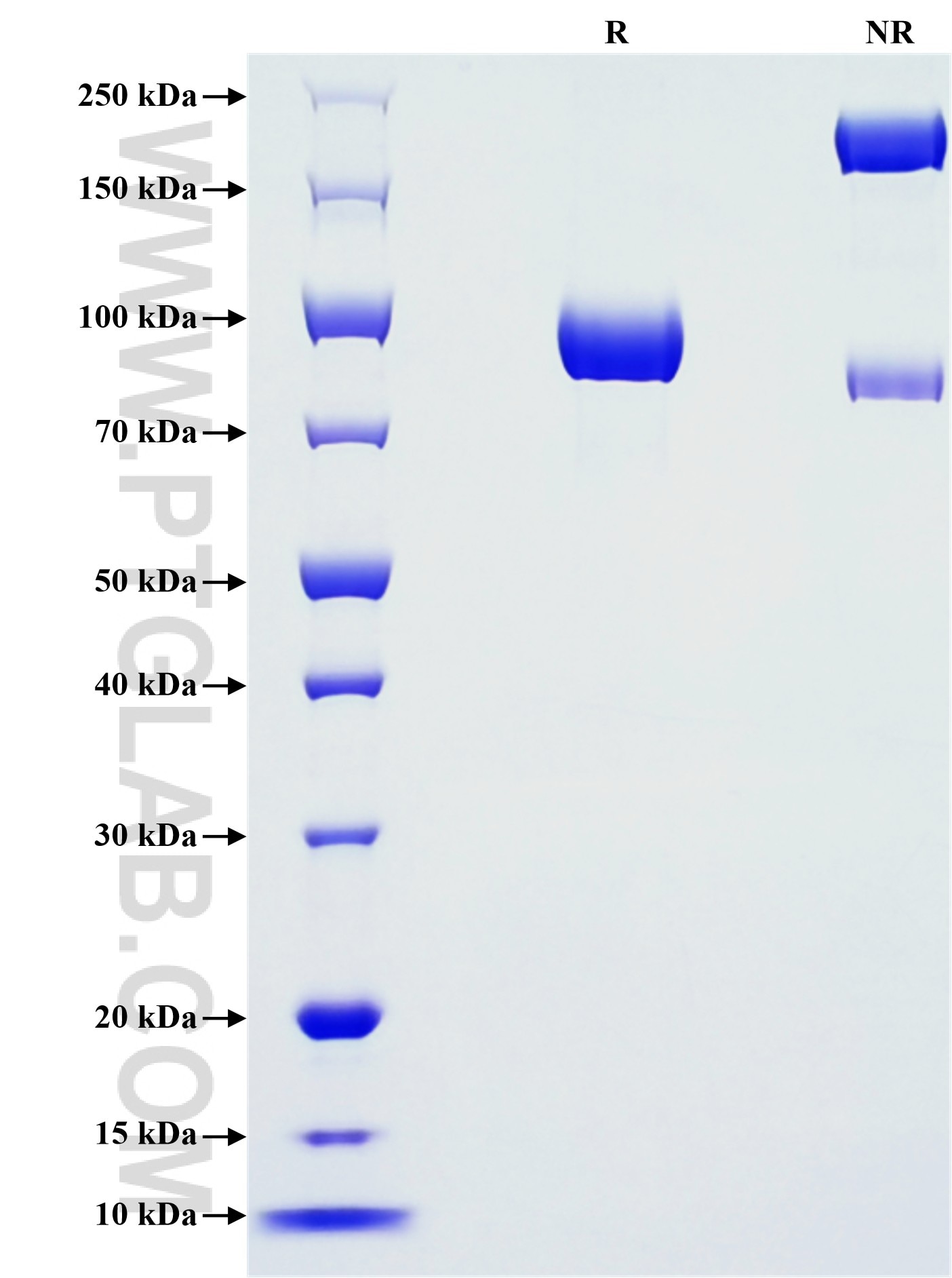 Purity of Recombinant Human EPHB4 was determined by SDS-PAGE. The protein was resolved in an SDS-PAGE in reducing (R) and non-reducing (NR) conditions and stained using Coomassie blue. Purity of Recombinant Human EPHB4 was determined by SDS-PAGE. The protein was resolved in an SDS-PAGE in reducing (R) and non-reducing (NR) conditions and stained using Coomassie blue.