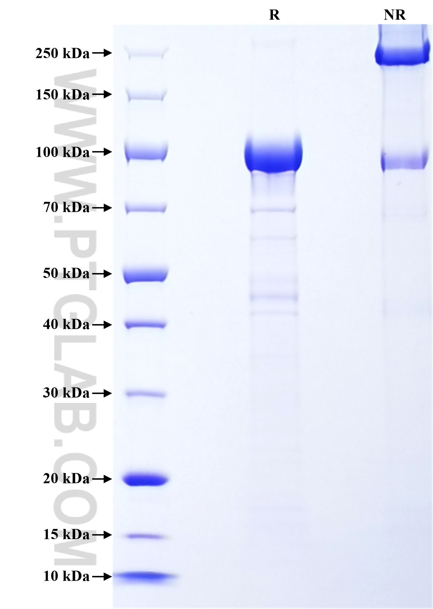 Purity of Recombinant Human DSG2 was determined by SDS-PAGE. The protein was resolved in an SDS-PAGE in reducing (R) and non-reducing (NR) conditions and stained using Coomassie blue. Purity of Recombinant Human DSG2 was determined by SDS-PAGE. The protein was resolved in an SDS-PAGE in reducing (R) and non-reducing (NR) conditions and stained using Coomassie blue.