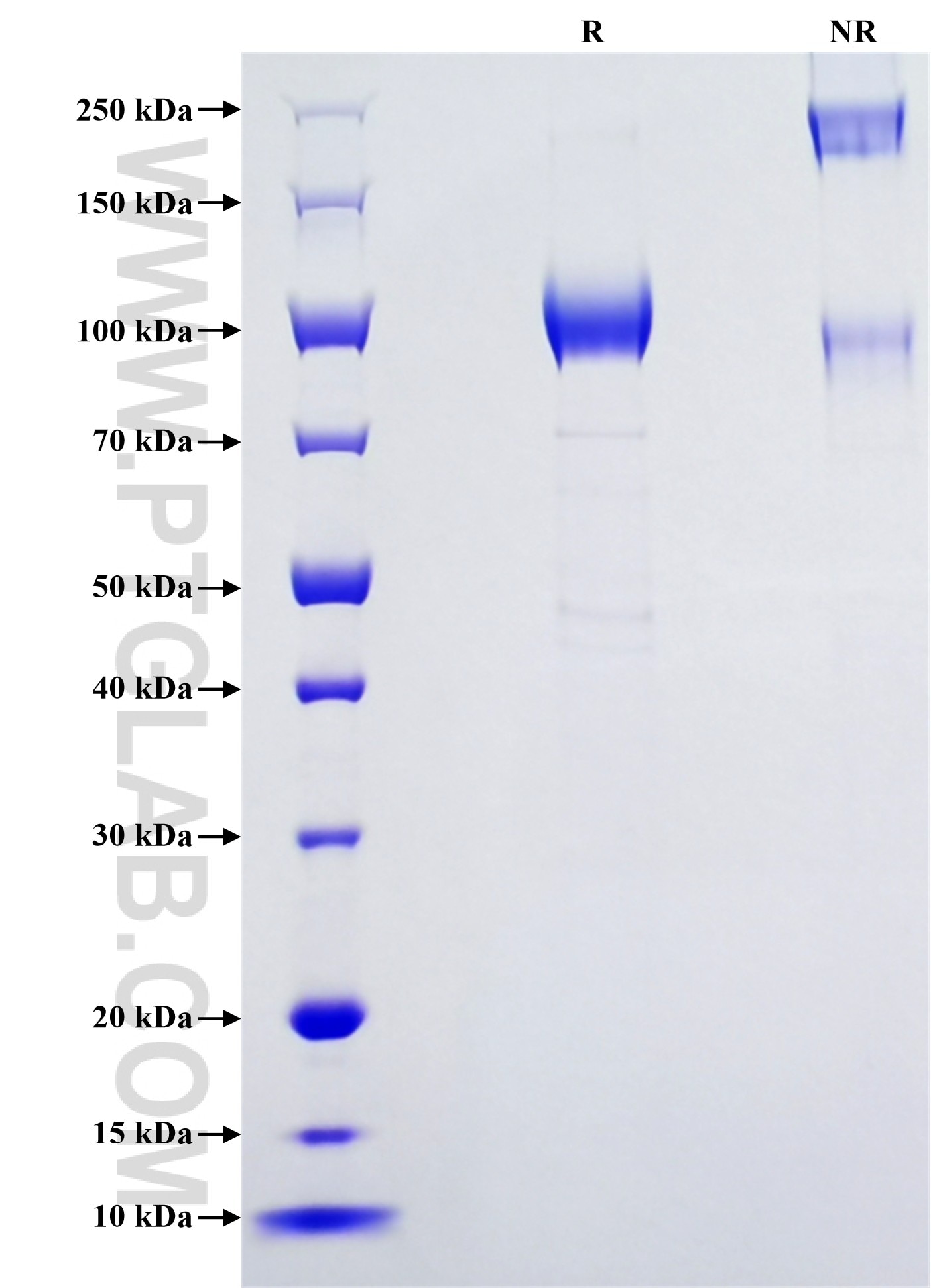 Purity of Recombinant Human Cubilin was determined by SDS-PAGE. The protein was resolved in an SDS-PAGE in reducing (R) and non-reducing (NR) conditions and stained using Coomassie blue.