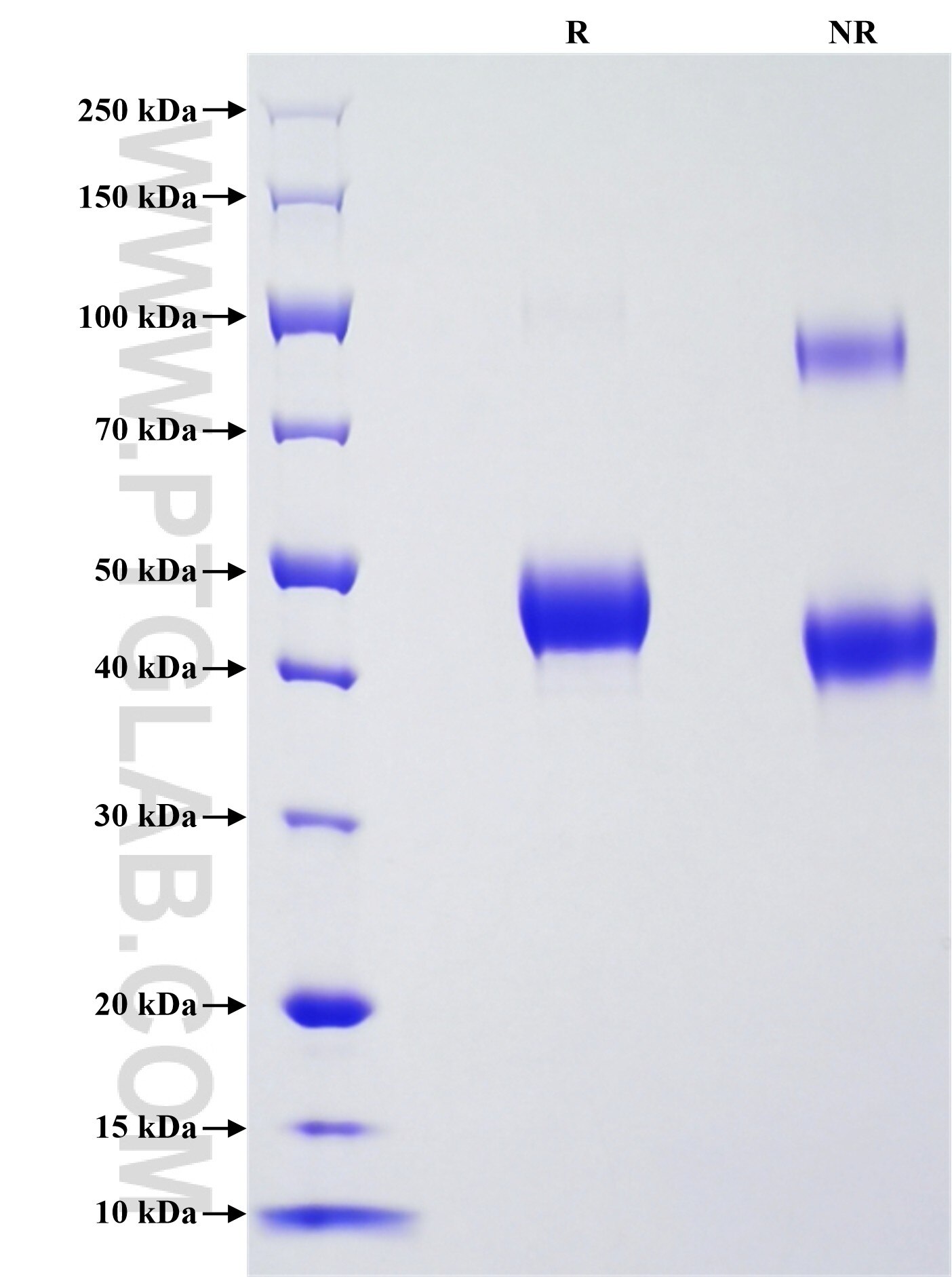 Purity of Recombinant Human BLNK was determined by SDS-PAGE. The protein was resolved in an SDS-PAGE in reducing (R) and non-reducing (NR) conditions and stained using Coomassie blue. Purity of Recombinant Human BLNK was determined by SDS-PAGE. The protein was resolved in an SDS-PAGE in reducing (R) and non-reducing (NR) conditions and stained using Coomassie blue.