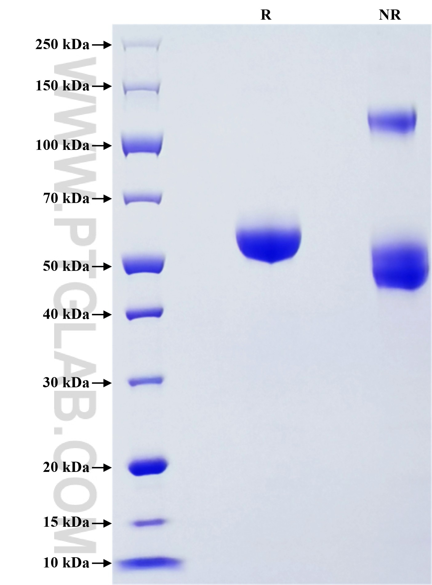 Purity of Recombinant Human JAM3 was determined by SDS-PAGE. The protein was resolved in an SDS-PAGE in reducing (R) and non-reducing (NR) conditions and stained using Coomassie blue. Purity of Recombinant Human JAM3 was determined by SDS-PAGE. The protein was resolved in an SDS-PAGE in reducing (R) and non-reducing (NR) conditions and stained using Coomassie blue.