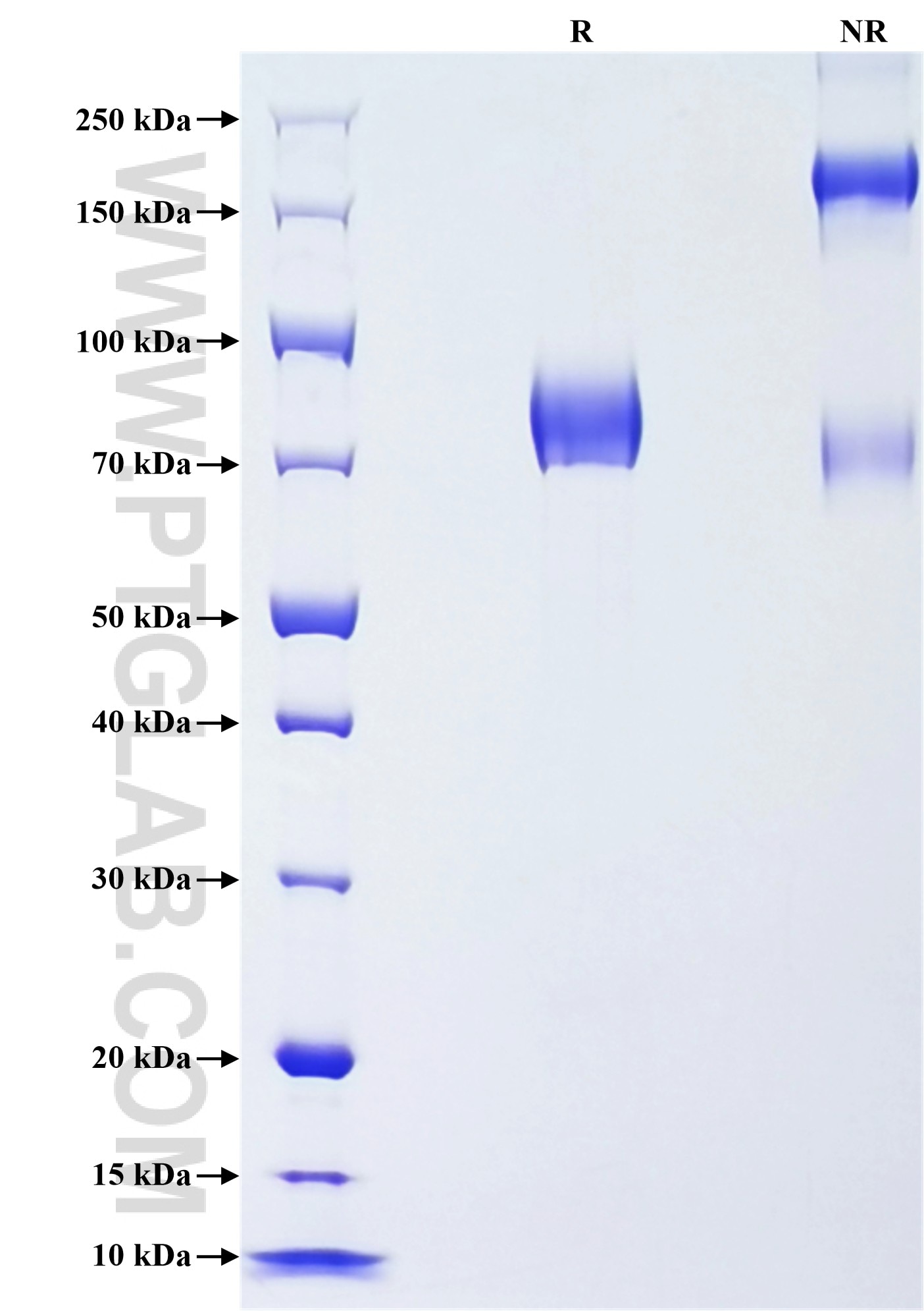 Purity of Recombinant Mouse IL-3RA was determined by SDS-PAGE. The protein was resolved in an SDS-PAGE in reducing (R) and non-reducing (NR) conditions and stained using Coomassie blue.