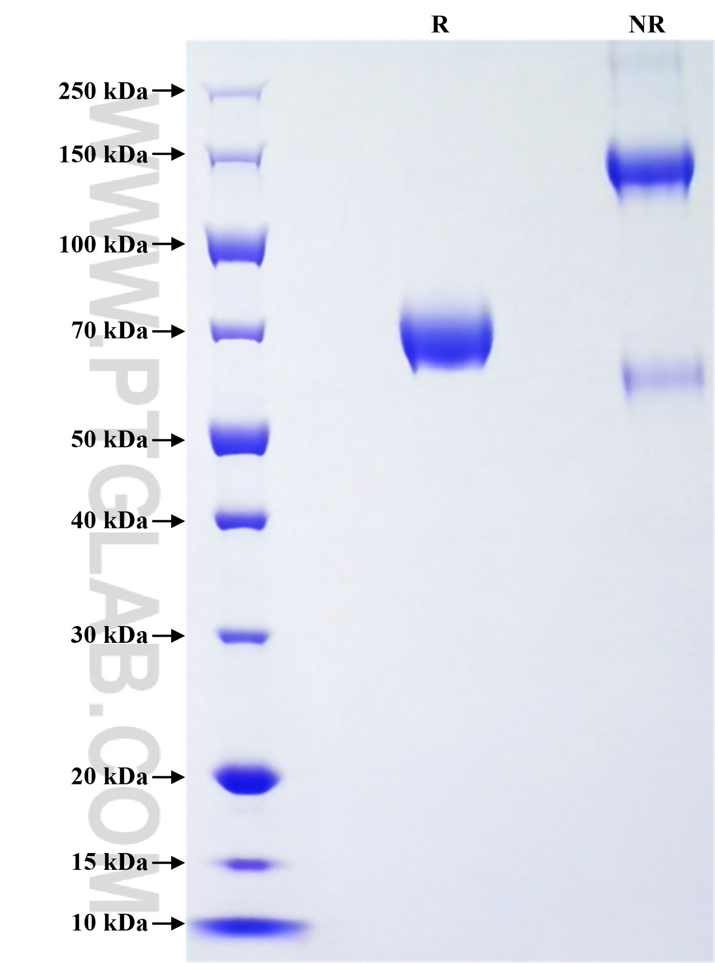 Purity of Recombinant Human VSIG1 was determined by SDS-PAGE. The protein was resolved in an SDS-PAGE in reducing (R) and non-reducing (NR) conditions and stained using Coomassie blue.