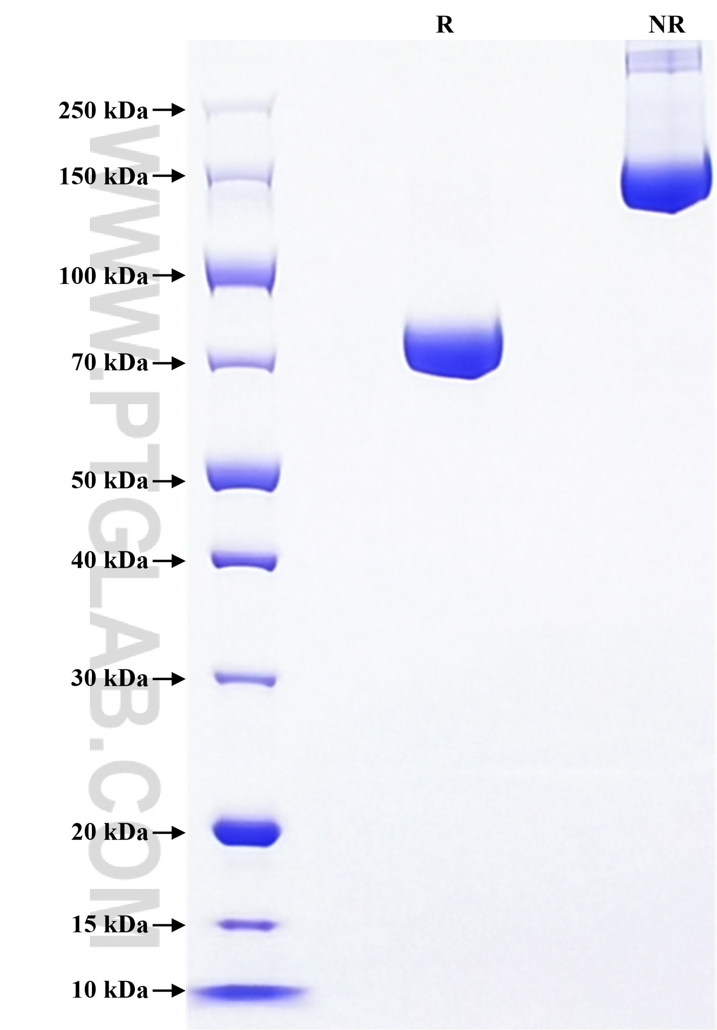 Purity of Recombinant Human IgM was determined by SDS-PAGE. The protein was resolved in an SDS-PAGE in reducing (R) and non-reducing (NR) conditions and stained using Coomassie blue. Purity of Recombinant Human IgM was determined by SDS-PAGE. The protein was resolved in an SDS-PAGE in reducing (R) and non-reducing (NR) conditions and stained using Coomassie blue.