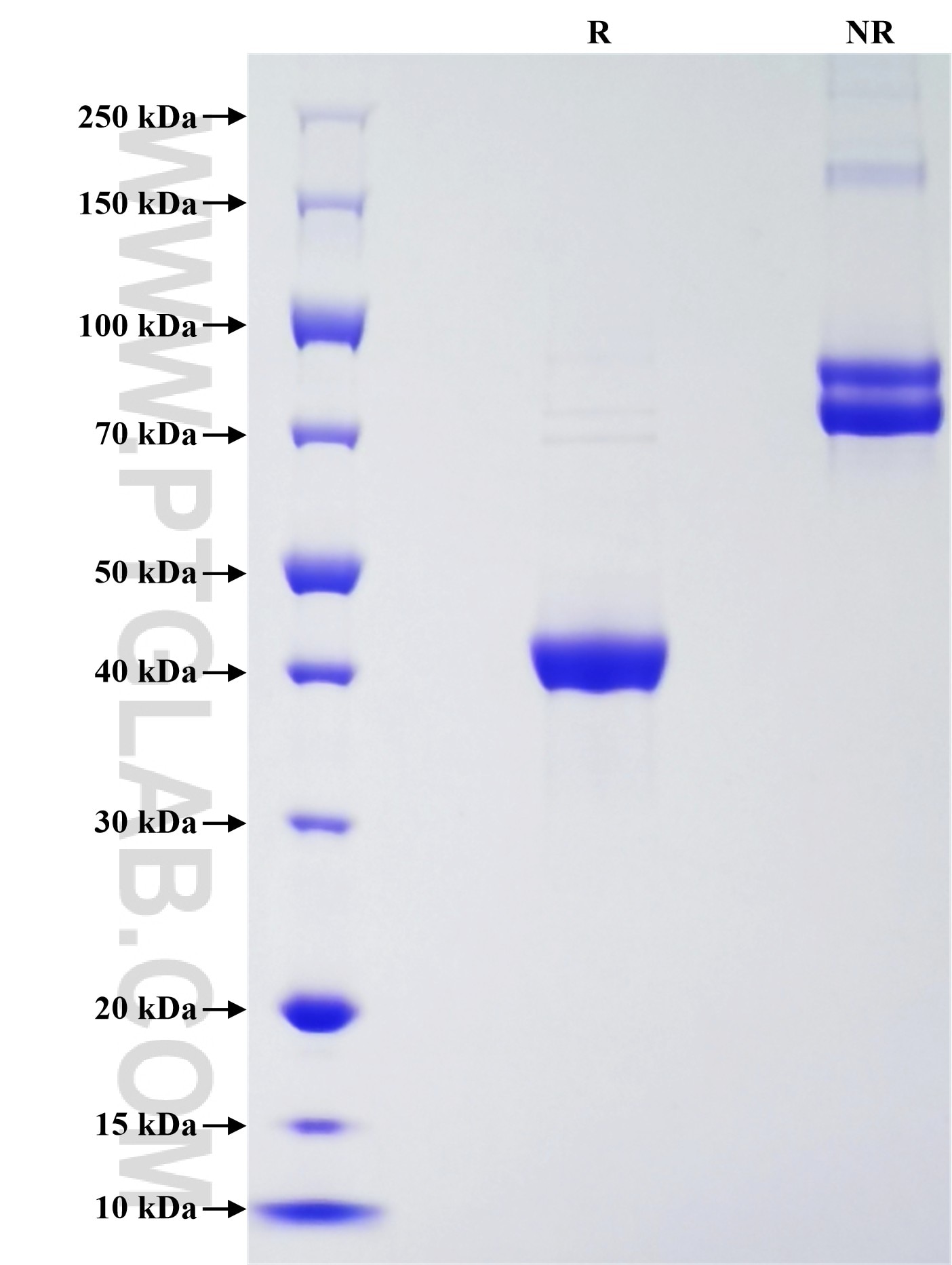 Purity of Recombinant Human MYO18A was determined by SDS-PAGE. The protein was resolved in an SDS-PAGE in reducing (R) and non-reducing (NR) conditions and stained using Coomassie blue.