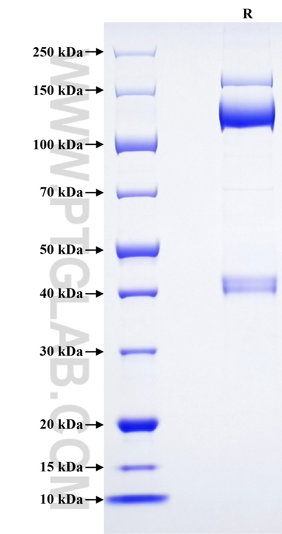 Purity of Recombinant Mouse PTPRD was determined by SDS-PAGE. The protein was resolved in an SDS-PAGE in reducing (R) conditions and stained using Coomassie blue. Purity of Recombinant Mouse PTPRD was determined by SDS-PAGE. The protein was resolved in an SDS-PAGE in reducing (R) conditions and stained using Coomassie blue.