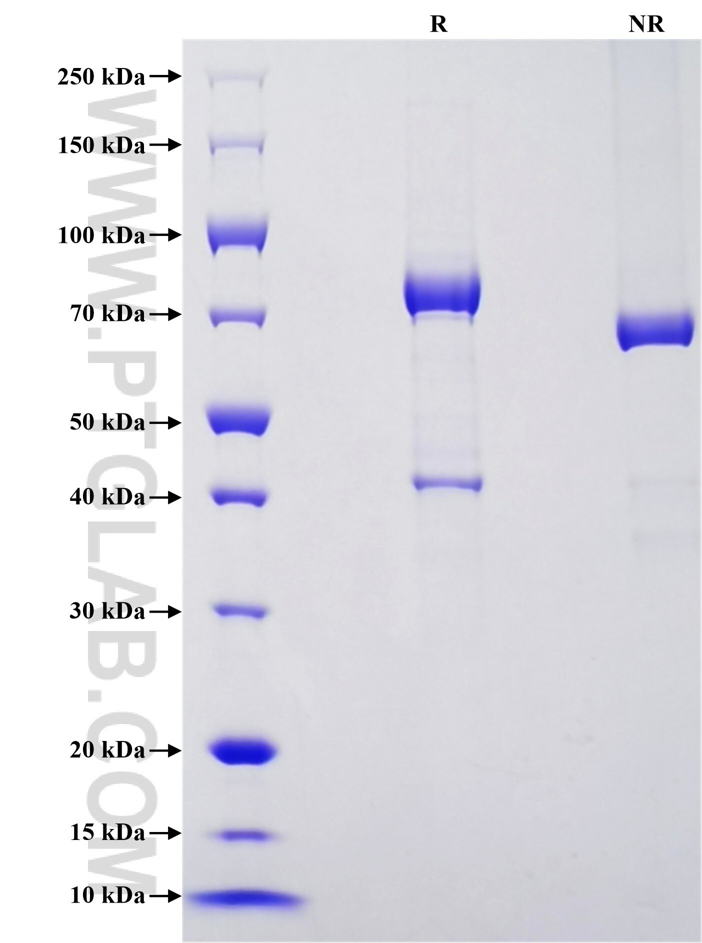 Purity of Recombinant Mouse Vitamin D binding protein was determined by SDS-PAGE. The protein was resolved in an SDS-PAGE in reducing (R) and non-reducing (NR) conditions and stained using Coomassie blue.