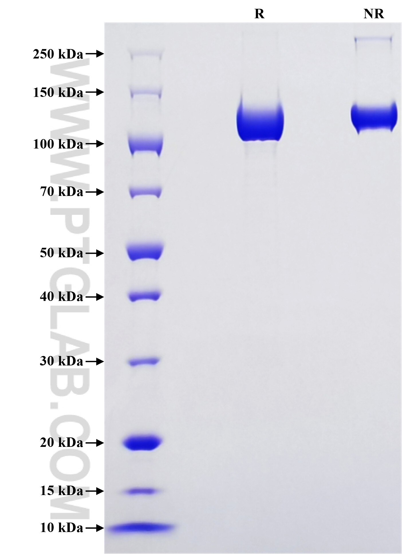 Purity of Recombinant Human ENPP2 was determined by SDS-PAGE. The protein was resolved in an SDS-PAGE in reducing (R) and non-reducing (NR) conditions and stained using Coomassie blue. Purity of Recombinant Human ENPP2 was determined by SDS-PAGE. The protein was resolved in an SDS-PAGE in reducing (R) and non-reducing (NR) conditions and stained using Coomassie blue.