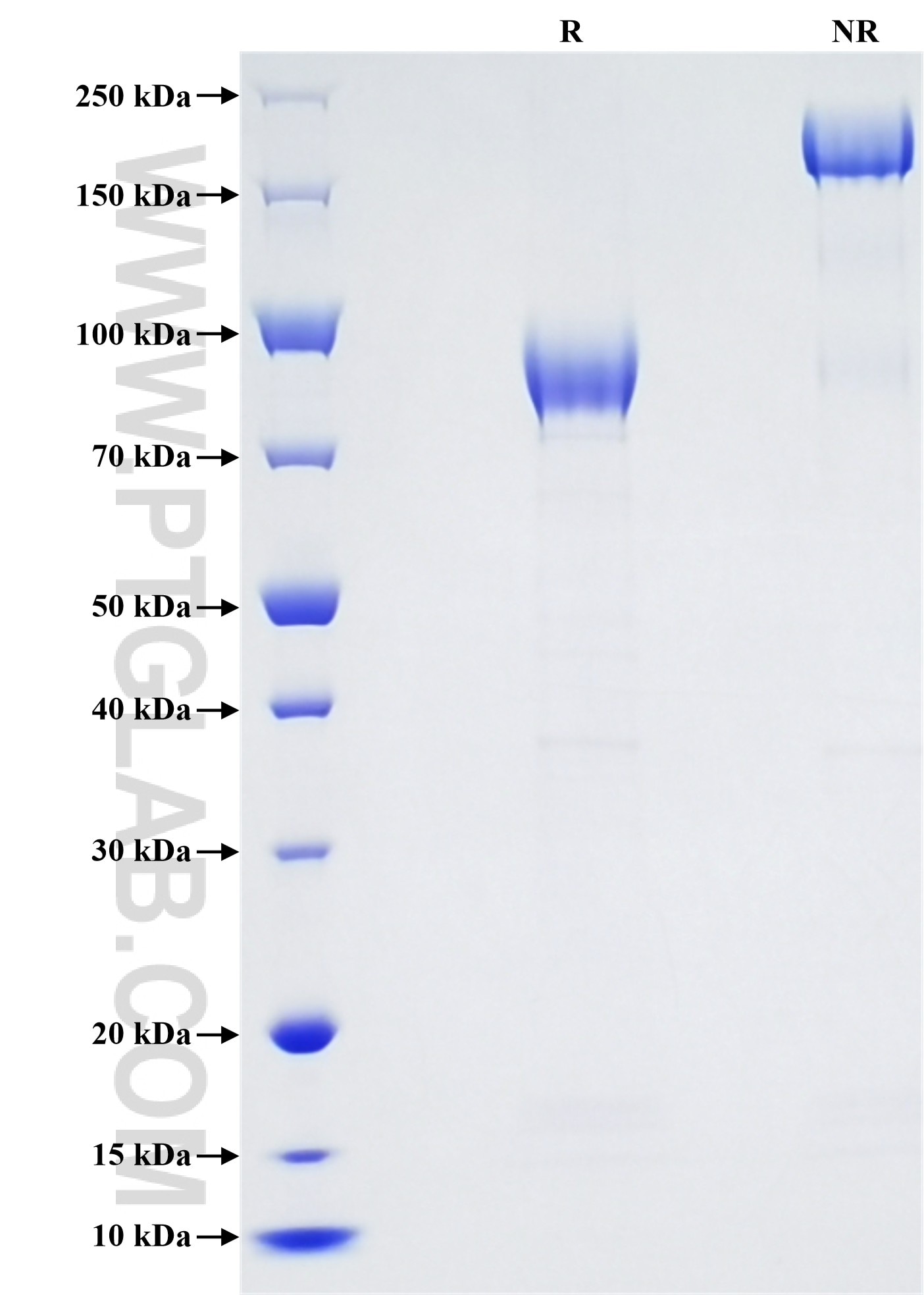 Purity of Recombinant Mouse TREML2 was determined by SDS-PAGE. The protein was resolved in an SDS-PAGE in reducing (R) and non-reducing (NR) conditions and stained using Coomassie blue.