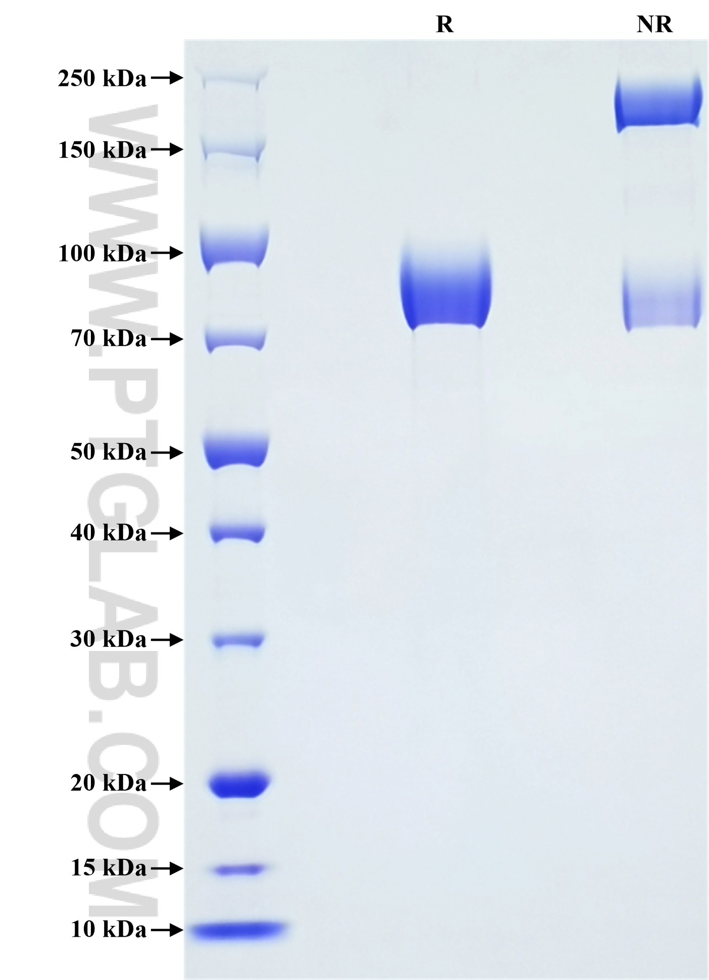 Purity of Recombinant Human ROBO4 was determined by SDS-PAGE. The protein was resolved in an SDS-PAGE in reducing (R) and non-reducing (NR) conditions and stained using Coomassie blue.