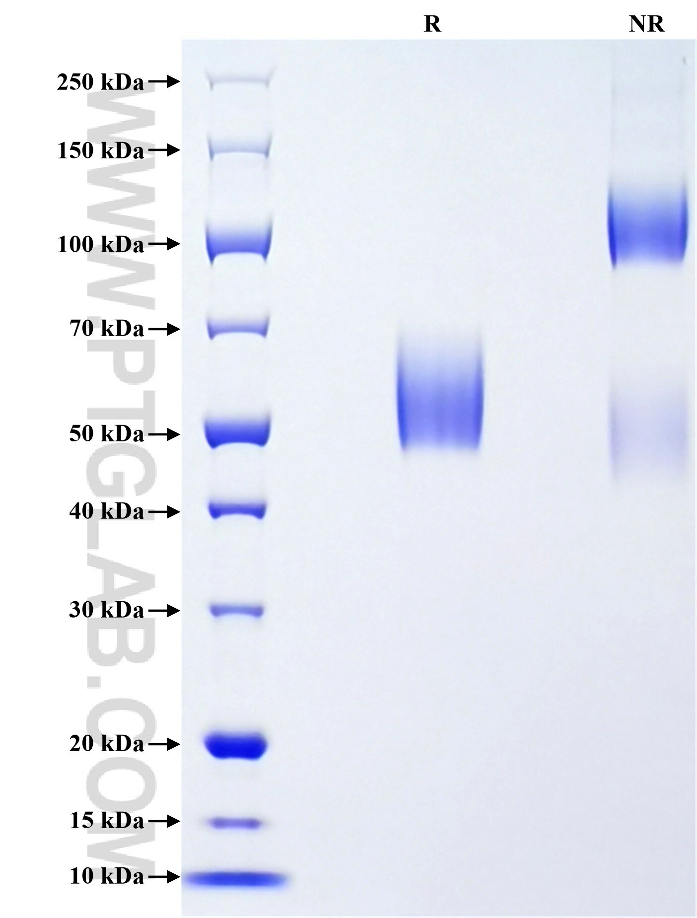 Purity of Recombinant Mouse RAMP2 was determined by SDS-PAGE. The protein was resolved in an SDS-PAGE in reducing (R) and non-reducing (NR) conditions and stained using Coomassie blue. Purity of Recombinant Mouse RAMP2 was determined by SDS-PAGE. The protein was resolved in an SDS-PAGE in reducing (R) and non-reducing (NR) conditions and stained using Coomassie blue.
