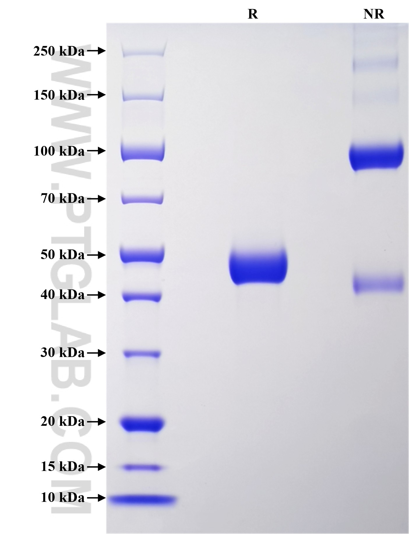 Purity of Recombinant Human NPC2 was determined by SDS-PAGE. The protein was resolved in an SDS-PAGE in reducing (R) and non-reducing (NR) conditions and stained using Coomassie blue. Purity of Recombinant Human NPC2 was determined by SDS-PAGE. The protein was resolved in an SDS-PAGE in reducing (R) and non-reducing (NR) conditions and stained using Coomassie blue.