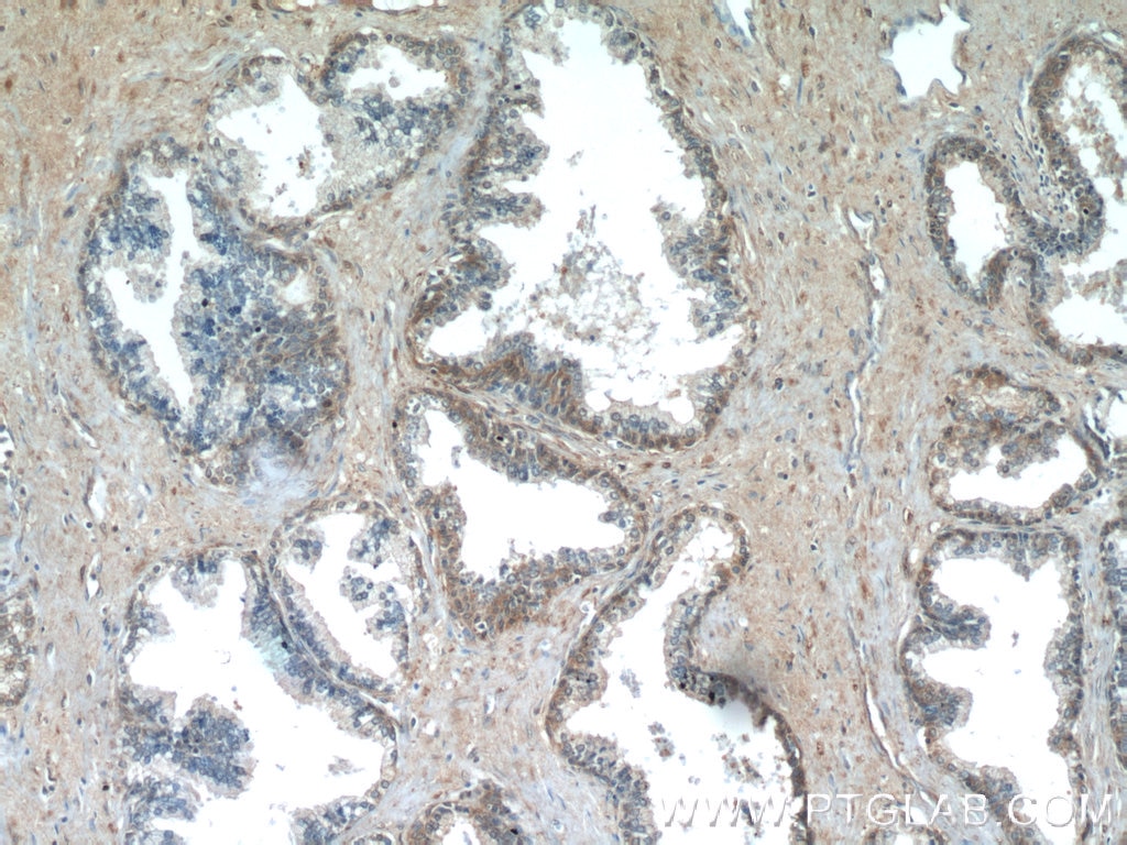Immunohistochemistry (IHC) staining of human prostate hyperplasia tissue using PAGE2 Polyclonal antibody (11961-1-AP)