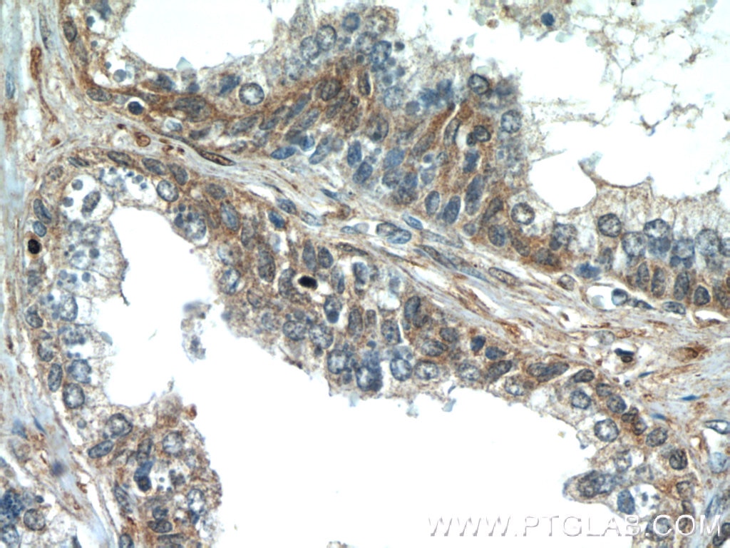 Immunohistochemistry (IHC) staining of human prostate hyperplasia tissue using PAGE2 Polyclonal antibody (11961-1-AP)