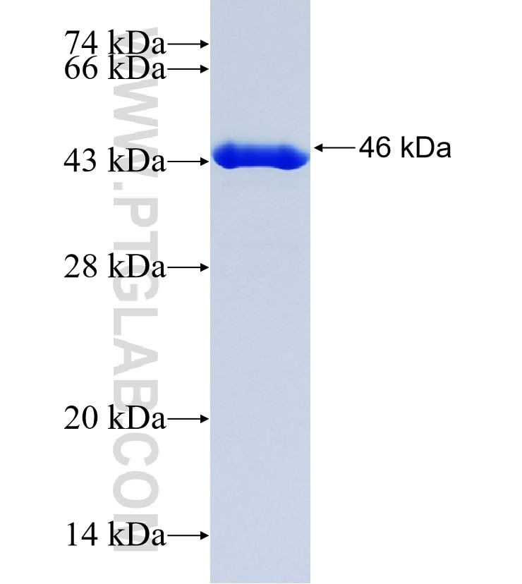 PAGE4 fusion protein Ag8727 SDS-PAGE