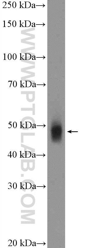 WB analysis of mouse kidney using 16347-1-AP