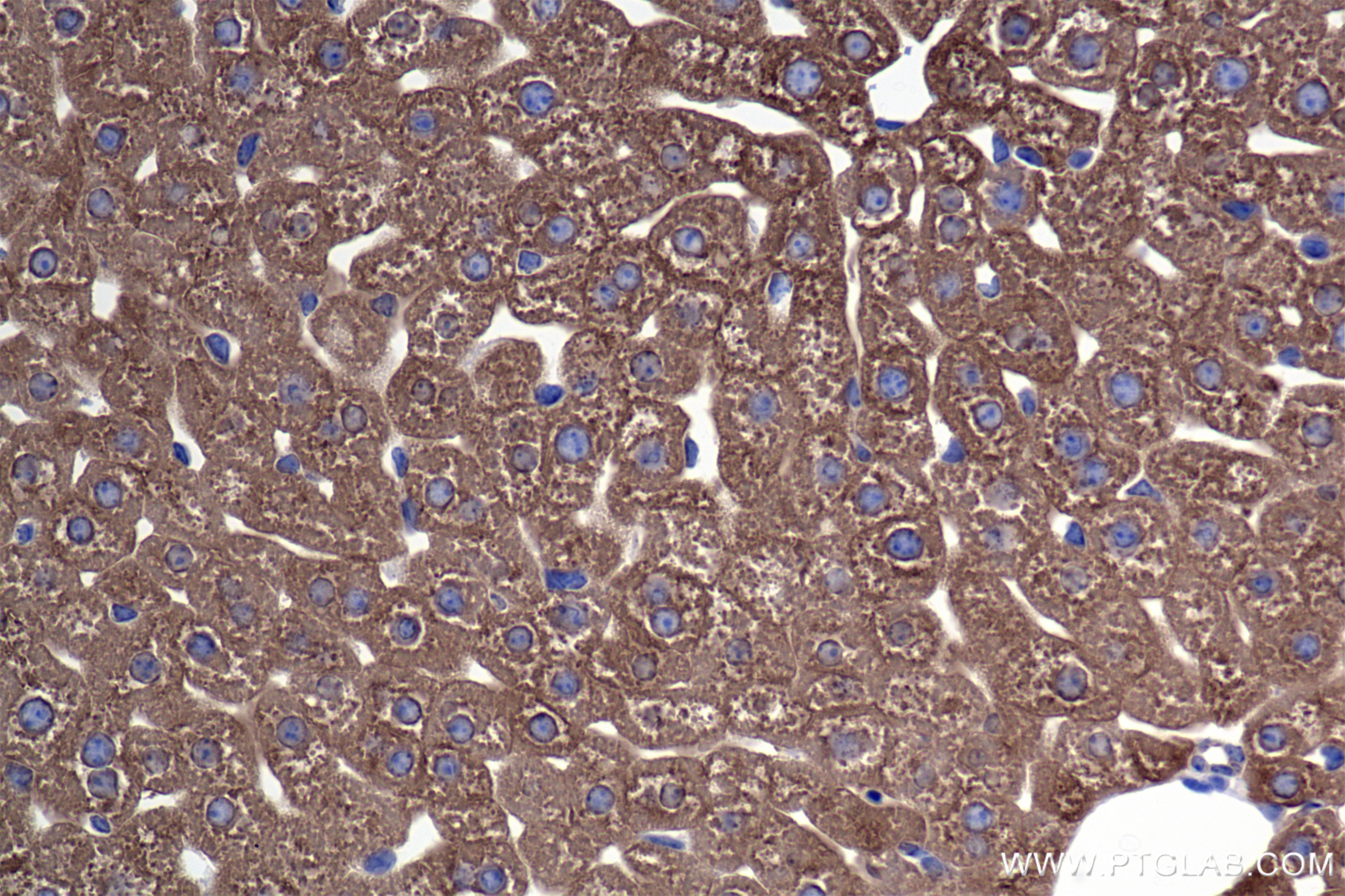 Immunohistochemical analysis of paraffin-embedded mouse liver tissue slide using 86231-2-RR (PAH antibody) at dilution of 1:600 (under 40x lens). Heat mediated antigen retrieval with Tris-EDTA buffer (pH 9.0). Immunohistochemistry (IHC) staining of mouse liver tissue using PAH Recombinant antibody (86231-2-RR)