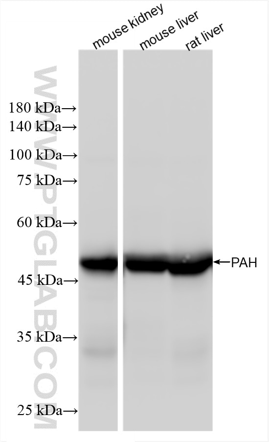 Western Blot (WB) analysis of various lysates using PAH Recombinant antibody (86231-2-RR)