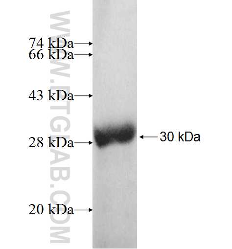 PAH fusion protein Ag9658 SDS-PAGE