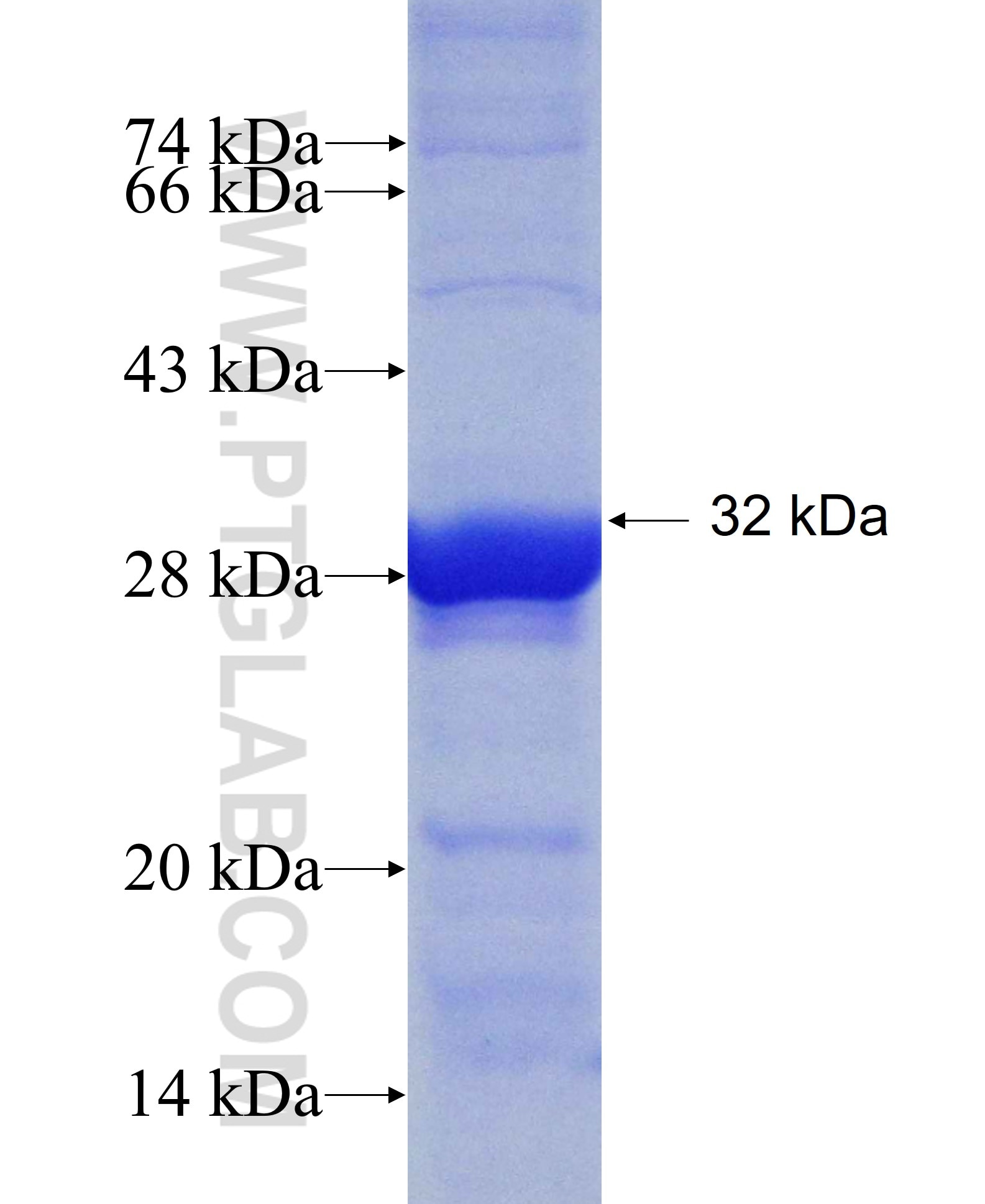 PAH fusion protein Ag9658 SDS-PAGE