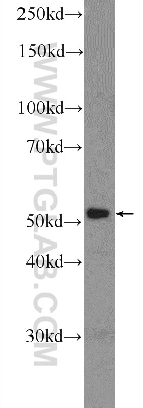 Western Blot (WB) analysis of RAW 264.7 cells using PAI-1 Polyclonal antibody (25522-1-AP)