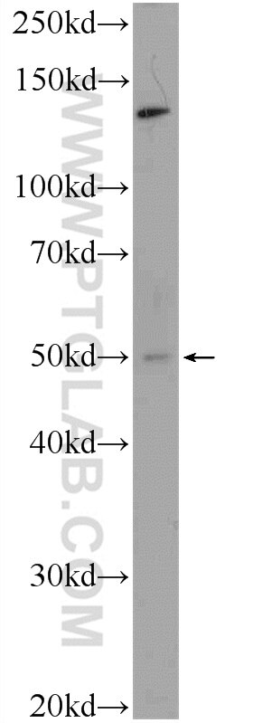 Western Blot (WB) analysis of human plasma using PAI-1 Polyclonal antibody (25522-1-AP)