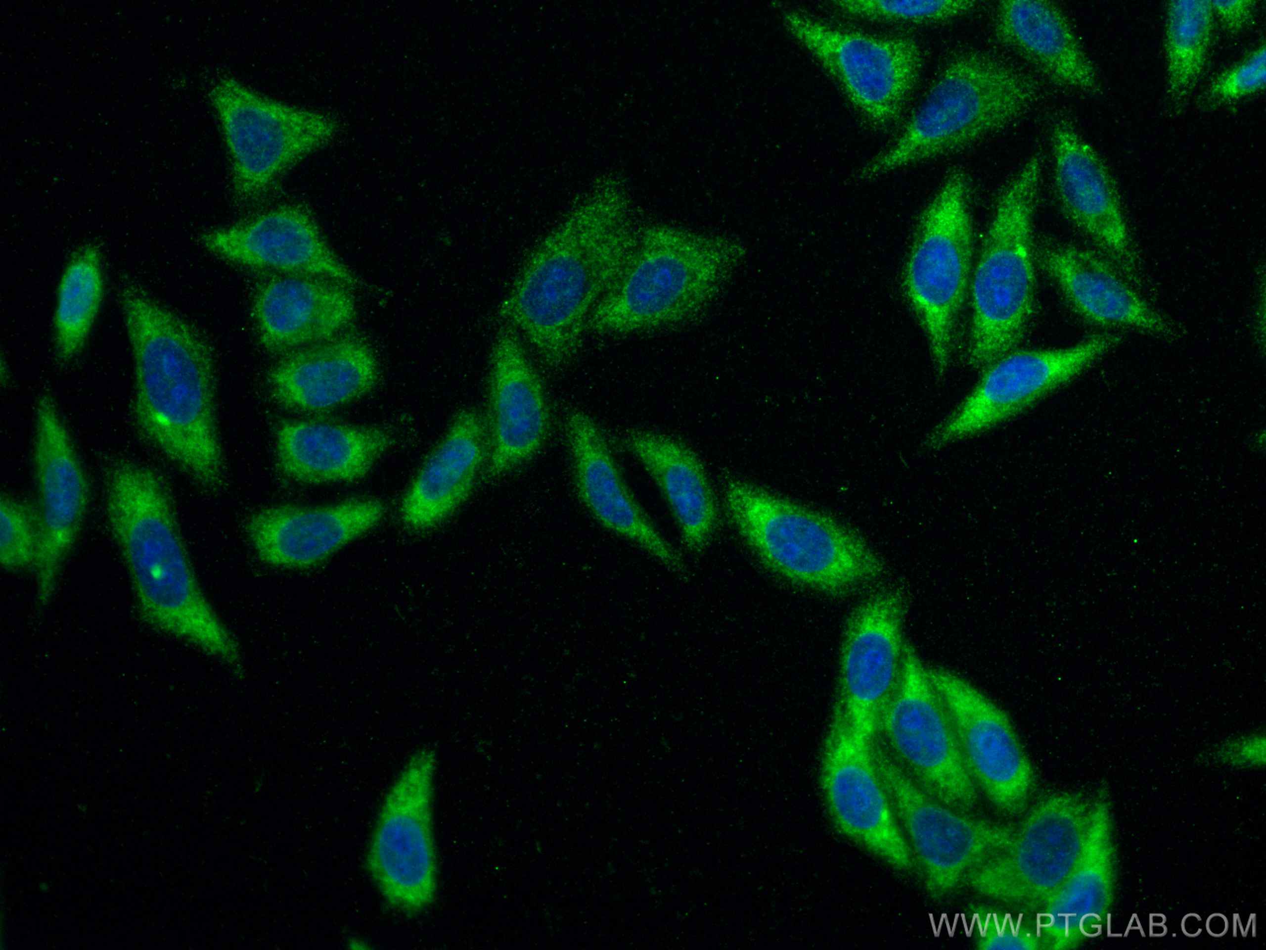 Immunofluorescence (IF) / fluorescent staining of HepG2 cells using PAI-1 Monoclonal antibody (66261-1-Ig)