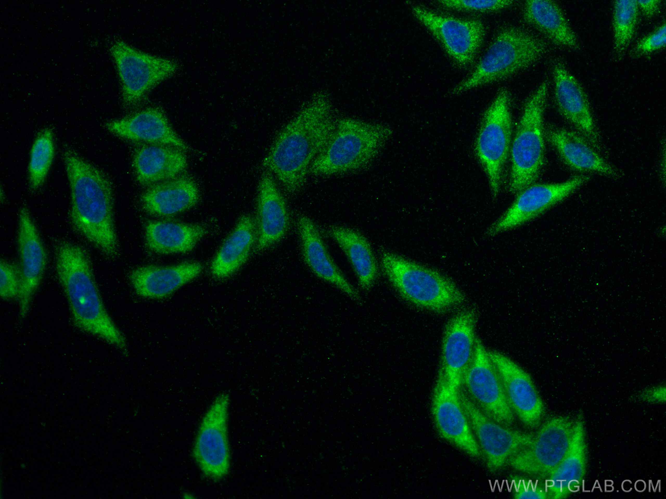 IF Staining of HepG2 using 66261-1-Ig