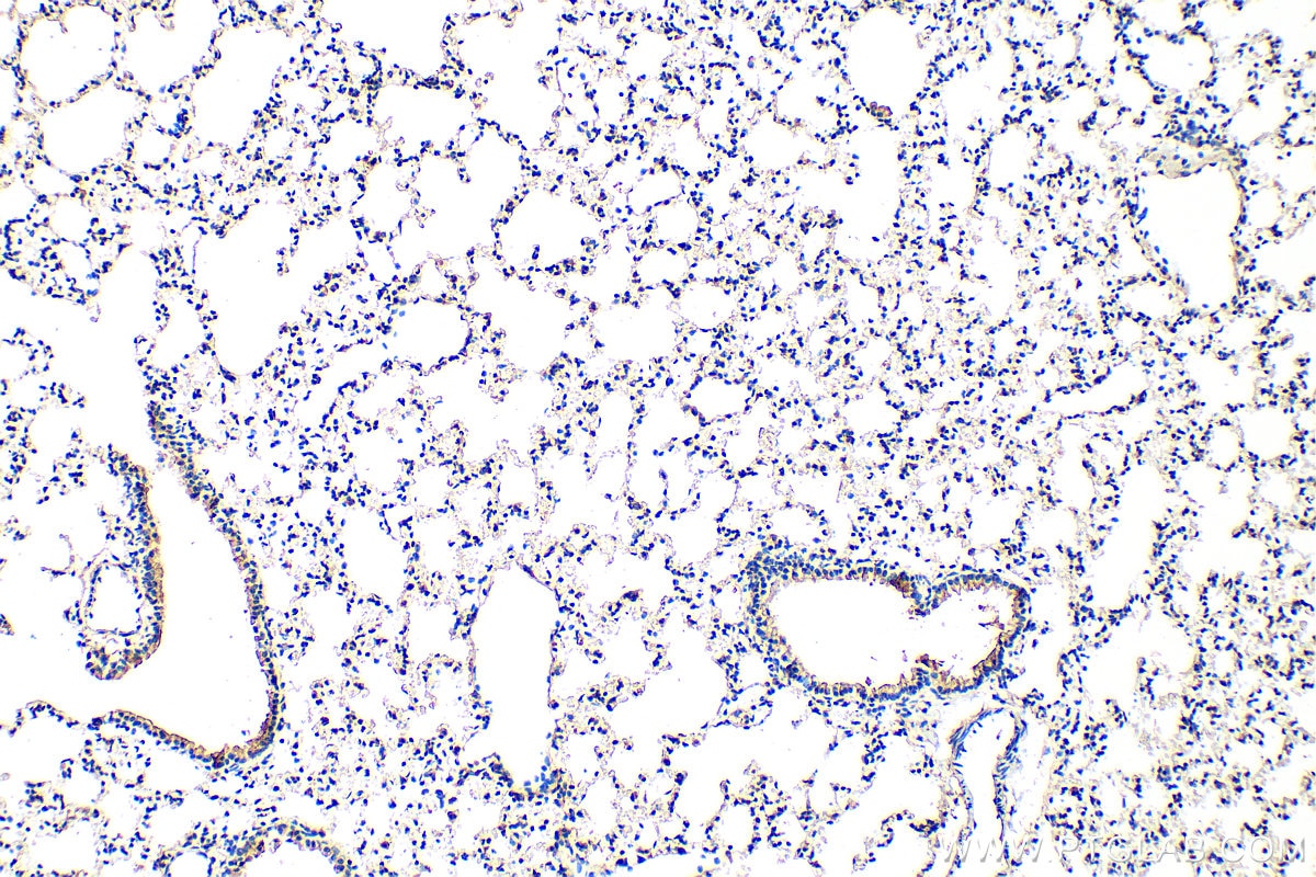 Immunohistochemistry (IHC) staining of mouse lung tissue using PAI-1 Monoclonal antibody (66261-1-Ig)