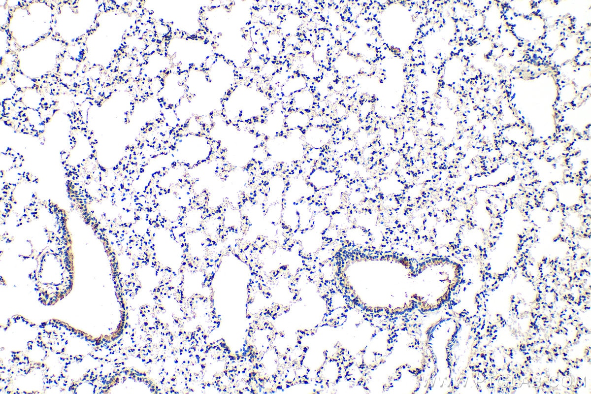 IHC staining of mouse lung using 66261-1-Ig