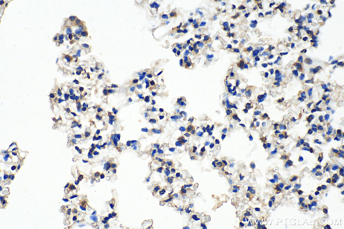 Immunohistochemistry (IHC) staining of mouse lung tissue using PAI-1 Monoclonal antibody (66261-1-Ig)