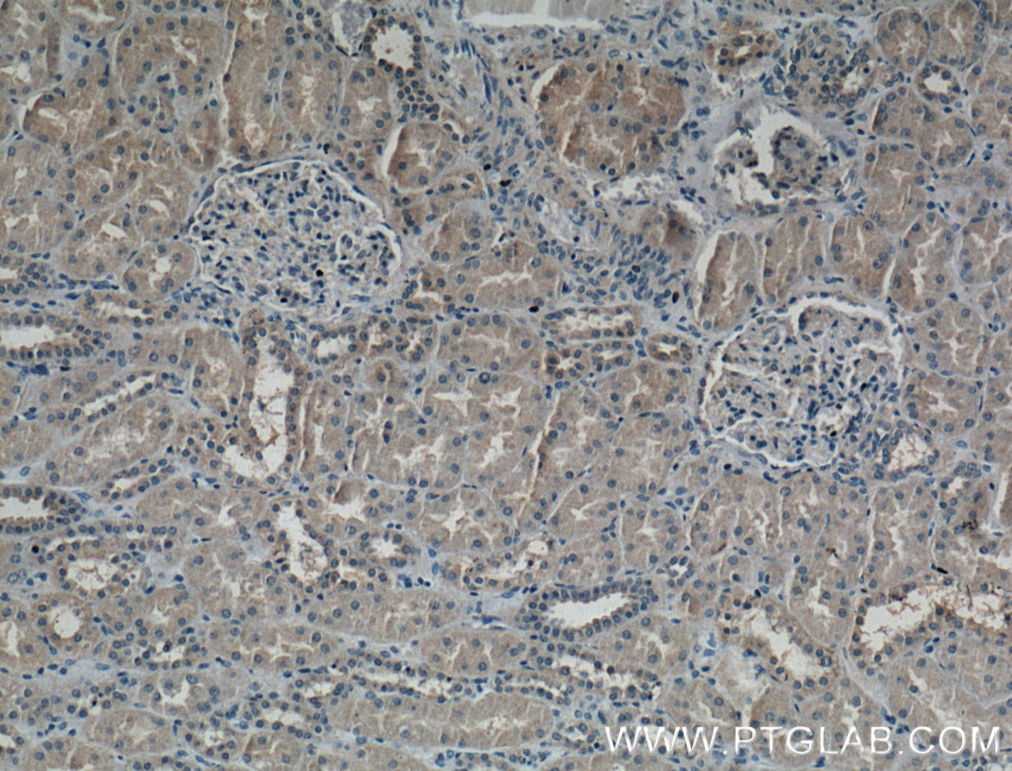 Immunohistochemistry (IHC) staining of human kidney tissue using PAI-1 Monoclonal antibody (66261-1-Ig)