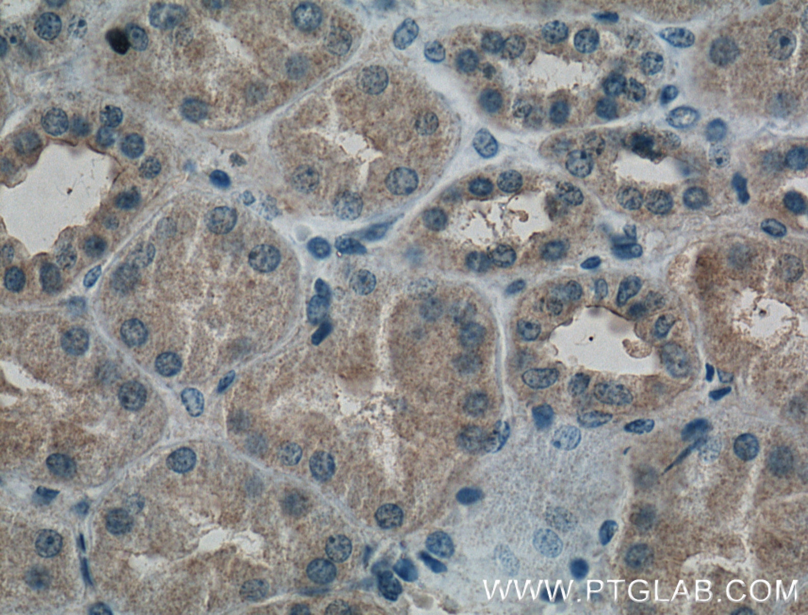 Immunohistochemistry (IHC) staining of human kidney tissue using PAI-1 Monoclonal antibody (66261-1-Ig)
