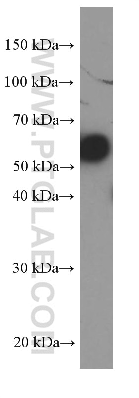 Western Blot (WB) analysis of pig liver tissue using PAI-1 Monoclonal antibody (66261-1-Ig)