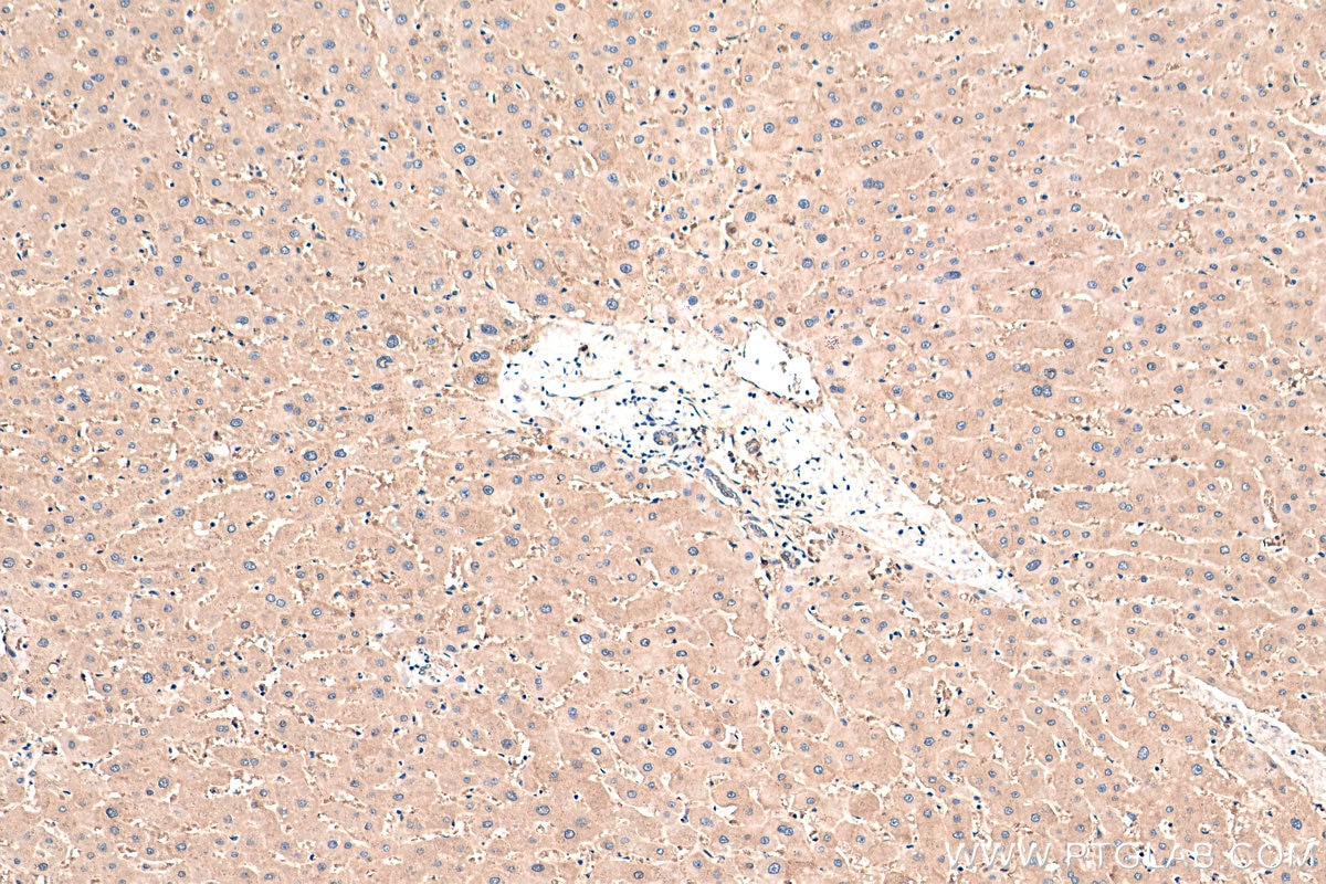 IHC staining of human liver using 12967-1-AP