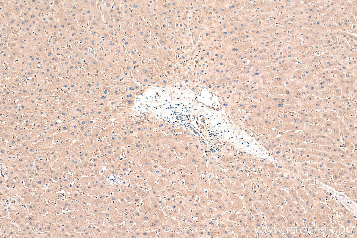 Immunohistochemistry (IHC) staining of human liver tissue using PAICS Polyclonal antibody (12967-1-AP)