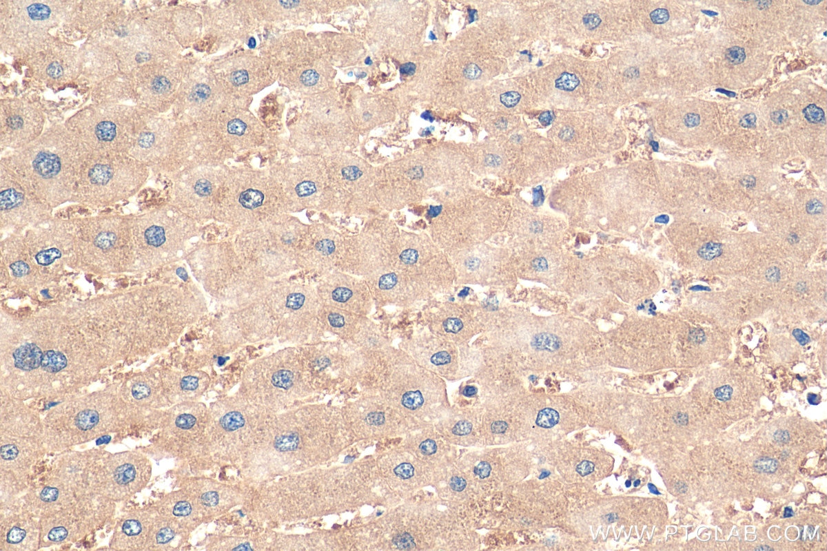 Immunohistochemistry (IHC) staining of human liver tissue using PAICS Polyclonal antibody (12967-1-AP)