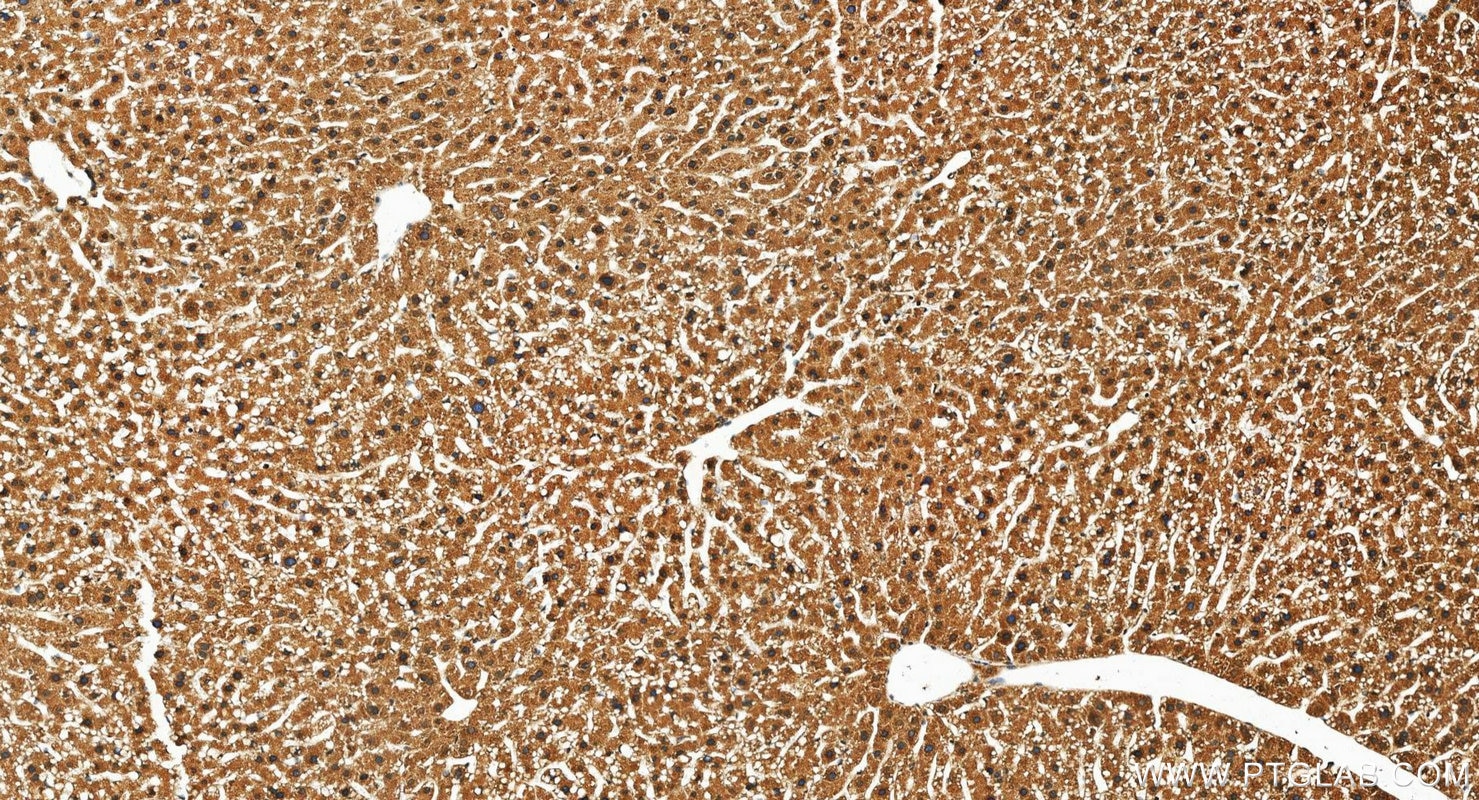 Immunohistochemistry (IHC) staining of mouse liver tissue using PAICS Polyclonal antibody (12967-1-AP)