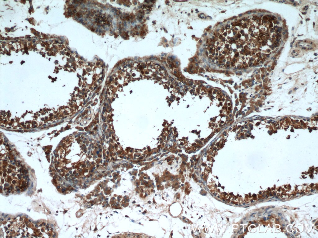 Immunohistochemistry (IHC) staining of human testis tissue using PAICS Polyclonal antibody (12967-1-AP)