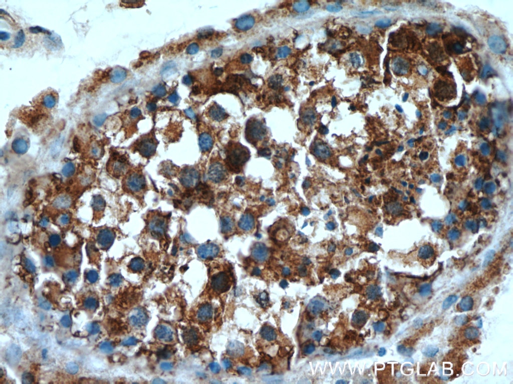 Immunohistochemistry (IHC) staining of human testis tissue using PAICS Polyclonal antibody (12967-1-AP)
