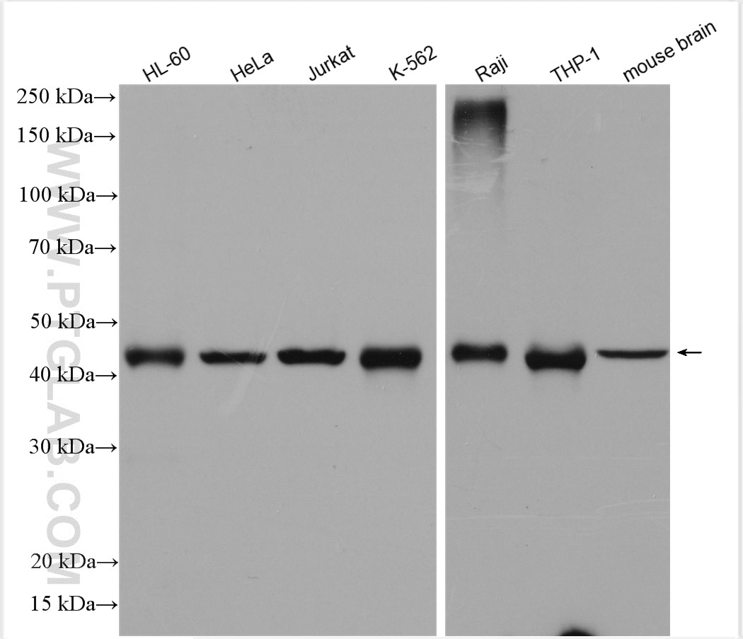Western Blot (WB) analysis of various lysates using PAICS Polyclonal antibody (12967-1-AP)